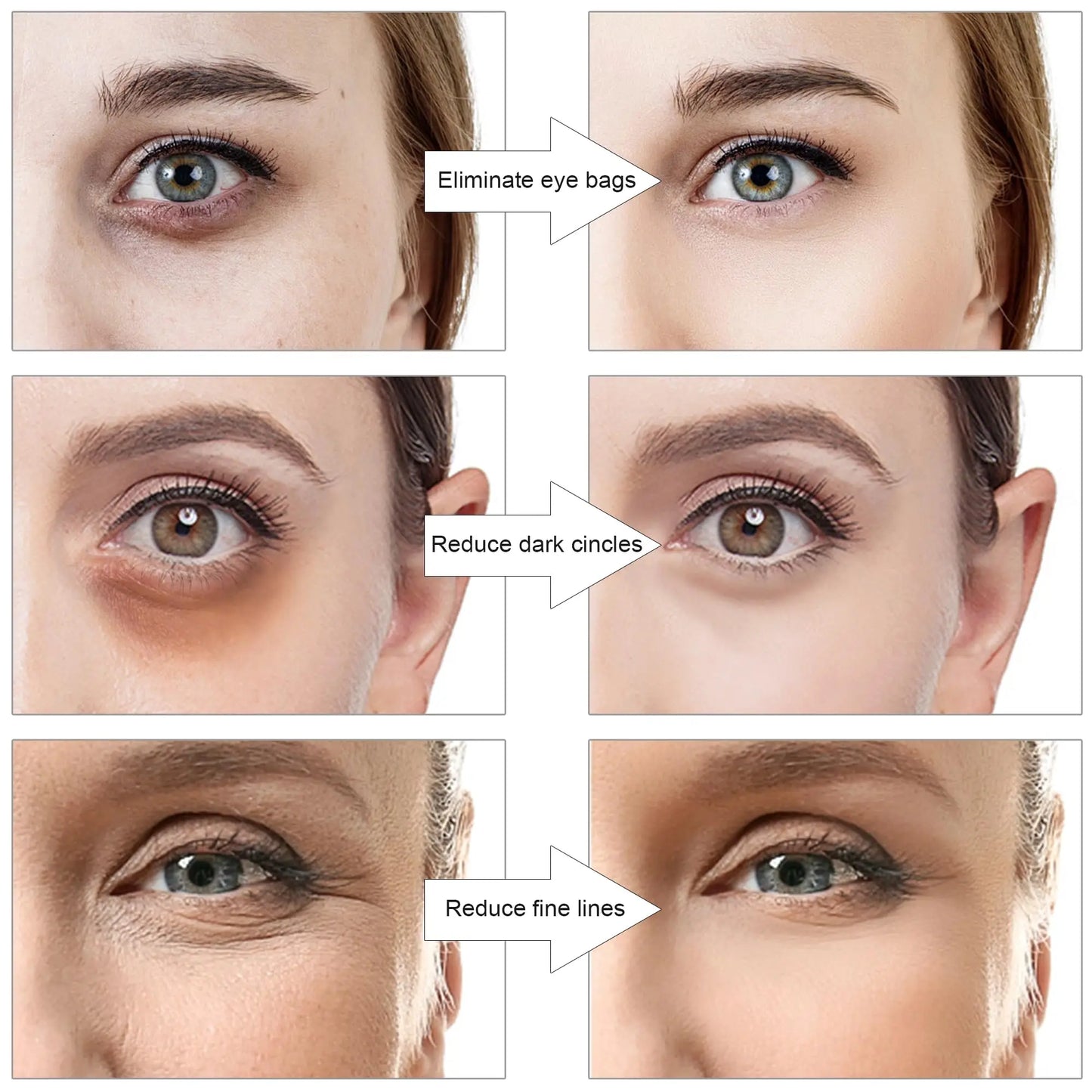 Eye Revive - Under Eye Revival Therapy